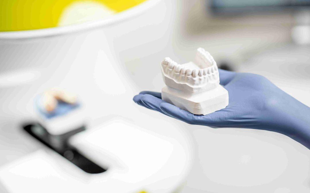 ¿Cómo Influye la Pérdida Dental en la Elección entre Prótesis Fijas y Removibles?